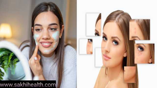 Pimple Marks 
