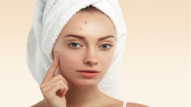 Pimple Scars Cream in