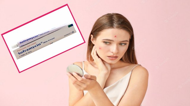 Framycetin Skin Cream