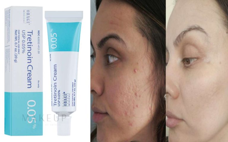 Tretinoin Cream